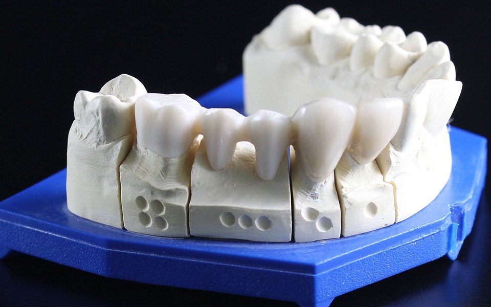 Hàm răng được sản xuất bằng công nghệ in 3D